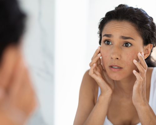 Can Home Treatments Remove Ice Pick Scars